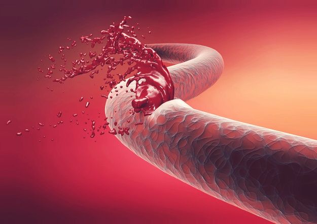 hemophilia, gujarati news, pravinsinh mori, pravinsinh, mori, હિમોફિલિયા પ્રવિણસિંહ. જે. મોરી, હિમોફિલિયા  પ્રવિણસિંહ મોરી, પ્રવિણસિંહ મોરી, પ્રવિણસિંહ, મોરી